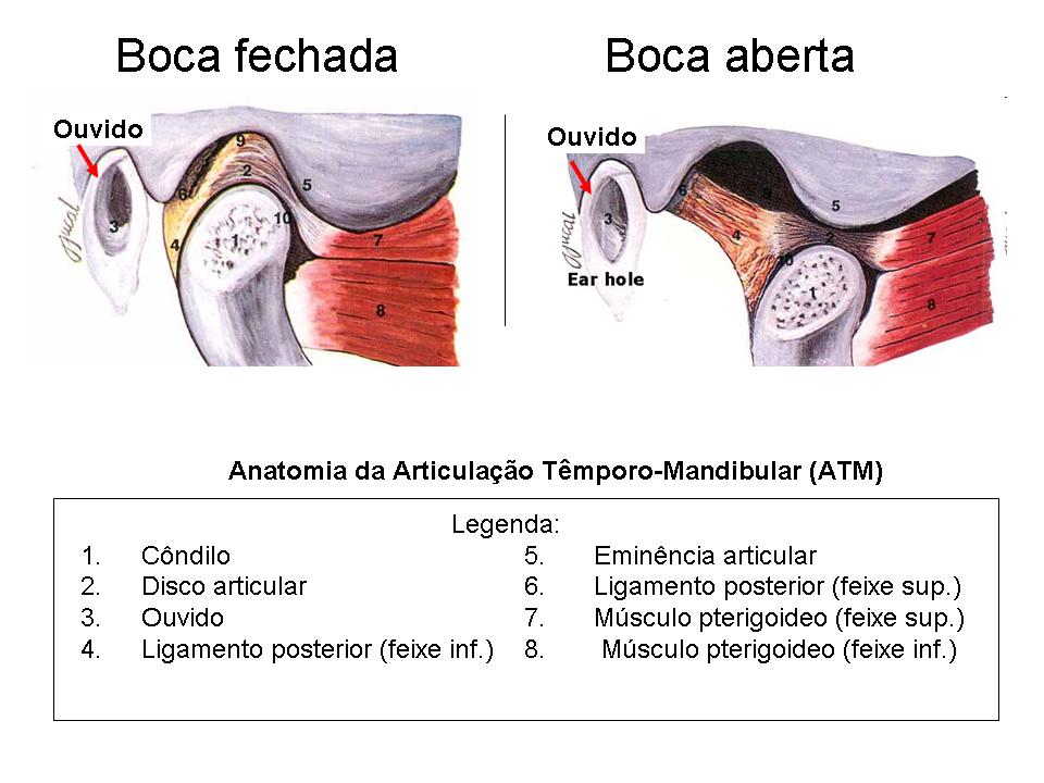 A mandíbula travada está relacionada com problemas na articulação  temporomandibular, conhecida como ATM. O disco articular dessa área pode  entrar em descompasso e se deslocar, o que resulta no incômodo e travamento