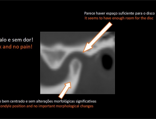 A RNM é importante para diagnóstico de lesões da ATM? / Is the MRI important for the dianosis of TMJ lesions?